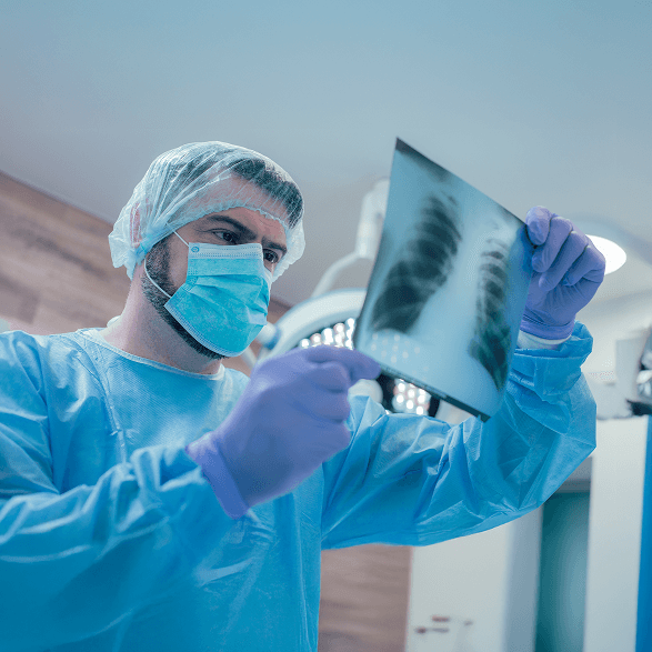 Doctor with chest X-ray